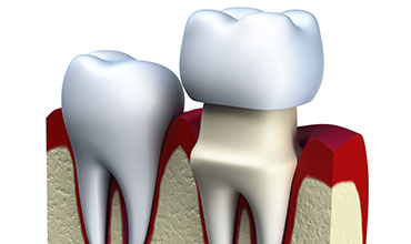 Prosthodontics